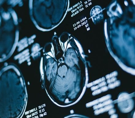 Artificial Intelligence (AI), Imaging and Radiotherapy Equipment, Associated Products and Diagnostic Imaging