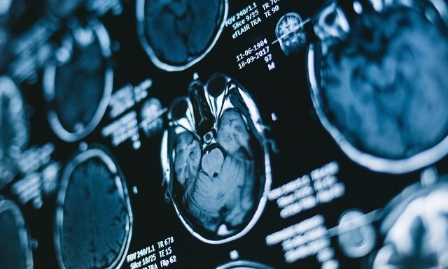 Artificial Intelligence (AI), Imaging and Radiotherapy Equipment, Associated Products and Diagnostic Imaging