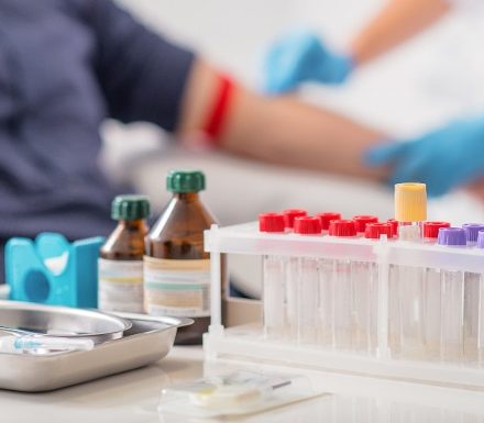 Drugs of Abuse and Point of Care Testing