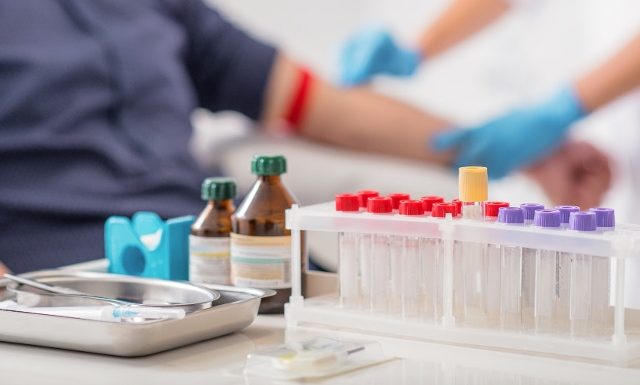 Drugs of Abuse and Point of Care Testing