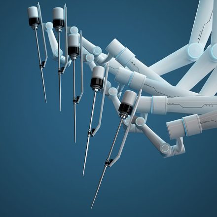 Surgical Robots: Revolutionising Healthcare in the NHS